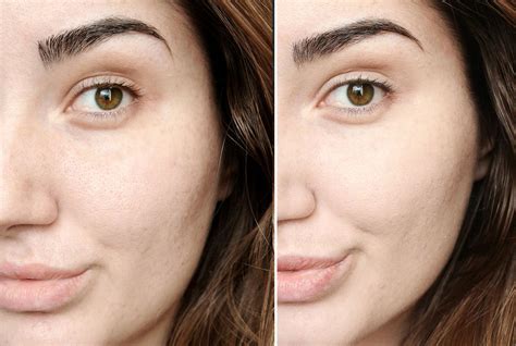 chanel foundation for oily skin price|Chanel foundation before and after.